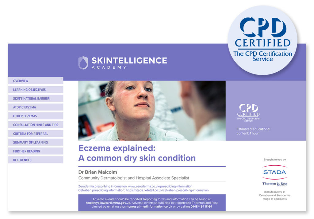 Eczema explained